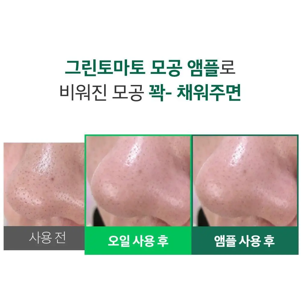 [말끔모공/블랙헤드] 성분에디터 그린토마토 모공 클렌징 오일 200ml 상세페이지 7